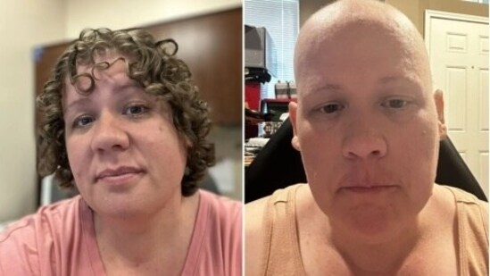 US woman was told she had terminal cancer and underwent 15 months of grueling chemotherapy, only to learn it was a misdiagnosis
