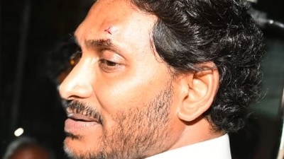Andhra Pradesh chief minister Jagan Mohan Reddy was injured on Saturday during his roadshow in Vijayawada.