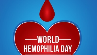 World Hemophilia Day 2024: The theme for this year's World Hemophilia Day is 'Equitable access for all: recognizing all bleeding disorders'. (Pixabay) World Hemophilia Day 2024: The theme for this year's World Hemophilia Day is 'Equitable access for all: recognizing all bleeding disorders'. (Pixabay)