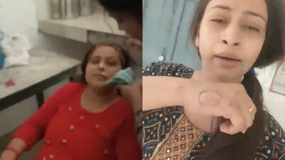 The principal (left), getting a facial in the school kitchen bites the teacher (right), who records her on camera. (X/@NCMIndiaa) The principal (left), getting a facial in the school kitchen bites the teacher (right), who records her on camera. (X/@NCMIndiaa)