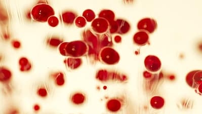 3.&nbsp;Arrhythmias: Anemia can predispose individuals to abnormal heart rhythms (arrhythmias). The imbalance in electrolytes caused by anemia, as well as the increased workload on the heart, can disrupt the normal electrical activity of the heart, leading to arrhythmias such as atrial fibrillation or ventricular arrhythmias. (Photo by Freepik)
