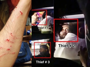 Bhuvann Ponnanna's injuries and thieves identified via Harshika Poonacha's post on Instagram Bhuvann Ponnanna's injuries and thieves identified via Harshika Poonacha's post on Instagram