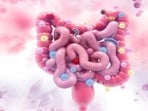 Diet plan, lifestyle changes to help prevent colorectal cancer 