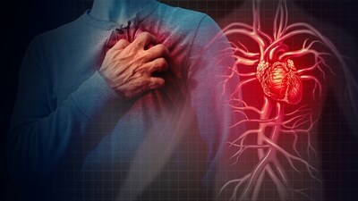 Researchers have developed a new AI-based model that can predict irregular heartbeat, or cardiac arrhythmia, about 30 minutes before its onset. (Twitter/PsychiatristCNS) Researchers have developed a new AI-based model that can predict irregular heartbeat, or cardiac arrhythmia, about 30 minutes before its onset. (Twitter/PsychiatristCNS)