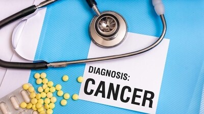 Silent signals: Know unseen signs and symptoms of cancer for swift detection (Photo by Shutterstock) Silent signals: Know unseen signs and symptoms of cancer for swift detection (Photo by Shutterstock)