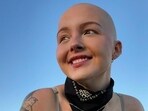 Maddy Baloy, beloved TikToker battling terminal Cancer, dies at 26