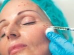 Planning to take a vampire facial? Make sure it's safe enough   