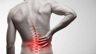 Adult spinal deformity refers to various abnormalities of spinal curvature and alignment. (Unsplash)