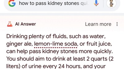 Google SGE's embarrassing AI advice on how to pass kidney stones quickly: drink urine ((Screenshot shared by Barry Schwartz))