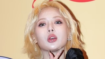 K-pop Star Hyuna Faces Health Challenges Due to Extreme Diet and Fainting Spells (File) K-pop Star Hyuna Faces Health Challenges Due to Extreme Diet and Fainting Spells (File)