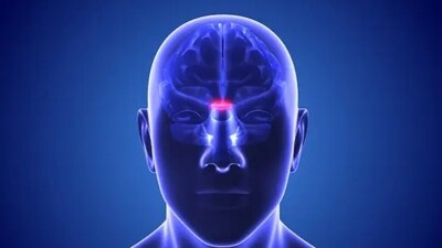 Ventricular shunts are used on children to treat hydrocephalus, a disorder caused by improper brain fluid drainage or absorption from tumors, brain bleeds, and other sources. (Unsplash) Ventricular shunts are used on children to treat hydrocephalus, a disorder caused by improper brain fluid drainage or absorption from tumors, brain bleeds, and other sources. (Unsplash)