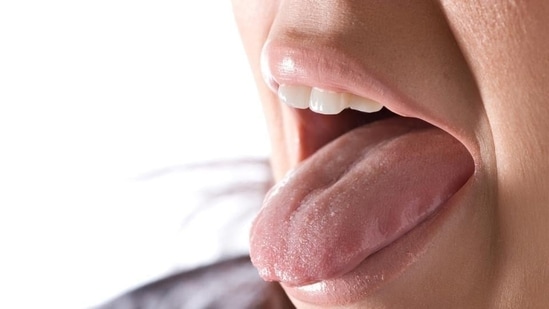 The functioning of Diaphragm can be affected by high Cortisol. It is responsible for more hiccups than normal.&nbsp;