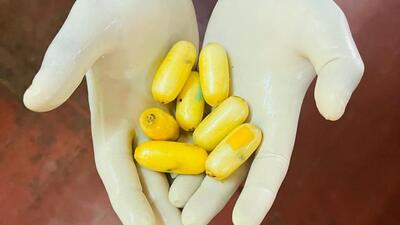The cocaine valued at ₹9.75 crore in the grey market was ingested in his stomach. The cocaine valued at ₹9.75 crore in the grey market was ingested in his stomach.