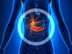 Gallstones: Causes, symptoms, diagnosis, stages, treatment and prevention 