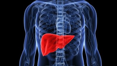 Fatty liver in diabetics, obese people: Causes, complications, treatment, 5 ways to prevent it (Photo by Twitter/AHealthyBod) Fatty liver in diabetics, obese people: Causes, complications, treatment, 5 ways to prevent it (Photo by Twitter/AHealthyBod)