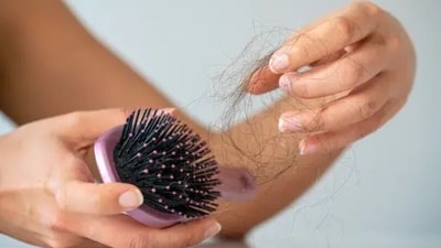 Insulin resistance is a common symptom in PCOS. With the elevated insulin levels, the body starts to produce more Androgen, leading to more hair loss. (Unsplash) Insulin resistance is a common symptom in PCOS. With the elevated insulin levels, the body starts to produce more Androgen, leading to more hair loss. (Unsplash)