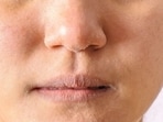 Experiencing dry and flaky skin? Here's how you can keep your skin hydrated Experiencing dry and flaky skin? Here's how you can keep your skin hydrated