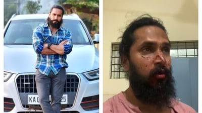 Chetan Chanddrra shares that a mob accused him of harassing a woman and attacked him in Bengaluru (Photos: Instagram/chetan_chanddrra) Chetan Chanddrra shares that a mob accused him of harassing a woman and attacked him in Bengaluru (Photos: Instagram/chetan_chanddrra)