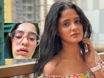 Ayesha Singh on her swollen face