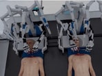 Snapshot of the procedure of the head transplant. 