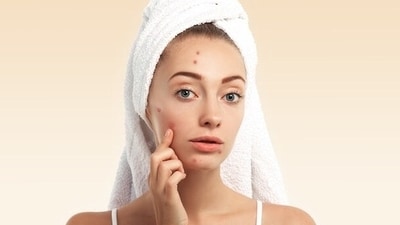 How a blood test can find the cause of your acne (Image by Freepik) How a blood test can find the cause of your acne (Image by Freepik)