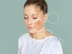 Every year, International Skin Pigmentation Day is observed on May 25. 