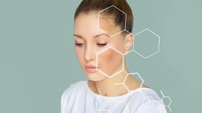 Every year, International Skin Pigmentation Day is observed on May 25. Every year, International Skin Pigmentation Day is observed on May 25.