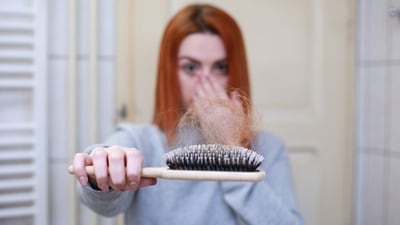 Watch out for these 4 genetic, hormonal, medical and lifestyle factors that cause hair loss in women (Photo by Pixabay) Watch out for these 4 genetic, hormonal, medical and lifestyle factors that cause hair loss in women (Photo by Pixabay)