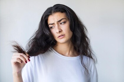 Sun damage to hair can cause thinning, hair loss and colour fading, among other things (Shutterstock)