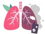 E-cigarettes contain toxic chemicals that are extremely harmful to the body