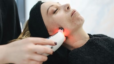 Innovative laser treatments for acne scars offer long-lasting results by targeting deeper skin layers and promoting collagen production. (Pexels) Innovative laser treatments for acne scars offer long-lasting results by targeting deeper skin layers and promoting collagen production. (Pexels)