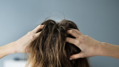 5. Scalp Health Matters: A healthy scalp is the foundation for healthy hair growth. Make sure to keep your scalp clean and hydrated. (File Photo) 5. Scalp Health Matters: A healthy scalp is the foundation for healthy hair growth. Make sure to keep your scalp clean and hydrated. (File Photo)