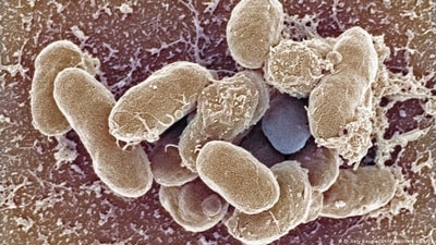 Antibiotic-resistant "superbugs" have become a top health concern around the world. Scientists creating new antibiotics are leading the fight against antimicrobial resistance. (DW/Dr.Gary Gaugler/OKAPIA/picture-alliance) Antibiotic-resistant "superbugs" have become a top health concern around the world. Scientists creating new antibiotics are leading the fight against antimicrobial resistance. (DW/Dr.Gary Gaugler/OKAPIA/picture-alliance)