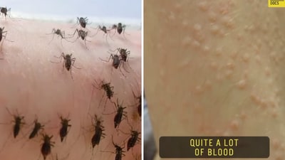 The before and after images of a biologist's hand after feeding mosquitoes. (Instagram/60secdocs)