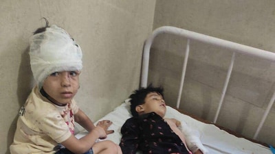 Children injured in the Reasi terror attack. Children injured in the Reasi terror attack.