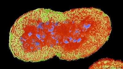 The Neisseria gonorrhea bacterium: Most women who get the STI gonorrhea are asymptomatic, which puts them at higher risk than men, who unmistakably know when they've got it. (DW/imago/Science Photo Library ) The Neisseria gonorrhea bacterium: Most women who get the STI gonorrhea are asymptomatic, which puts them at higher risk than men, who unmistakably know when they've got it. (DW/imago/Science Photo Library )
