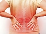 Stiff person syndrome is an autoimmune disorder that leads to muscle stiffness and painful spasms  