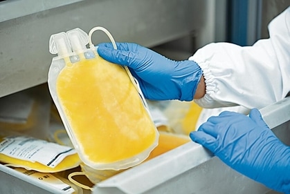 Plasma exchange is among the treatment options sought for SPS (Shutterstock) Plasma exchange is among the treatment options sought for SPS (Shutterstock)