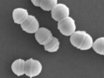 A total of 977 cases of streptococcal toxic shock syndrome (STSS) have been discovered in the country by June 2. A total of 977 cases of streptococcal toxic shock syndrome (STSS) have been discovered in the country by June 2.