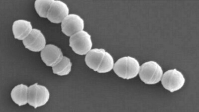 A total of 977 cases of streptococcal toxic shock syndrome (STSS) have been discovered in the country by June 2. (NHK/National Institute of Infectious Diseases) A total of 977 cases of streptococcal toxic shock syndrome (STSS) have been discovered in the country by June 2. (NHK/National Institute of Infectious Diseases)