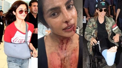 Bollywood divas who got hurt on set Bollywood divas who got hurt on set