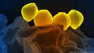 Infections from Streptococcus pyogenes bacteria are on the rise in Japan. Infections cause a deadly disease called Streptococcal toxic shock syndrome, or STSS. (IMAGE POINT FR/NIH/NIAID/BSIP/picture alliance ) Infections from Streptococcus pyogenes bacteria are on the rise in Japan. Infections cause a deadly disease called Streptococcal toxic shock syndrome, or STSS. (IMAGE POINT FR/NIH/NIAID/BSIP/picture alliance )
