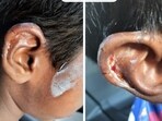 The five-year-old child approached the dog after being told it was friendly, however, the dog reportedly grabbed the child's earlobe, causing minor injury.