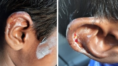 The five-year-old child approached the dog after being told it was friendly, however, the dog reportedly grabbed the child's earlobe, causing minor injury. The five-year-old child approached the dog after being told it was friendly, however, the dog reportedly grabbed the child's earlobe, causing minor injury.