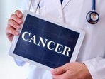 Transform your cancer battle: Why comprehensive care hospitals are essential Transform your cancer battle: Why comprehensive care hospitals are essential