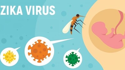 Zika virus alert for pregnant women: New measures and updated guidelines for expectant mothers (Photo by Twitter/OphthTimes) Zika virus alert for pregnant women: New measures and updated guidelines for expectant mothers (Photo by Twitter/OphthTimes)