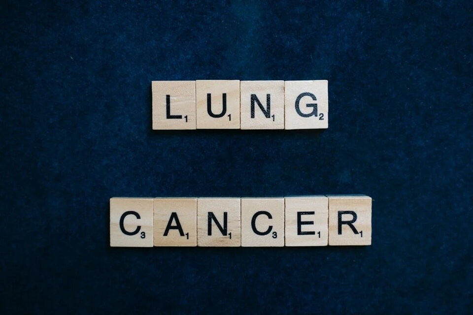 In this study, the researchers showed that that the low-dose radiation bath was not associated with excess secondary cancers, long-term toxicity or survival with long-term follow-up. (Pexels) In this study, the researchers showed that that the low-dose radiation bath was not associated with excess secondary cancers, long-term toxicity or survival with long-term follow-up. (Pexels)
