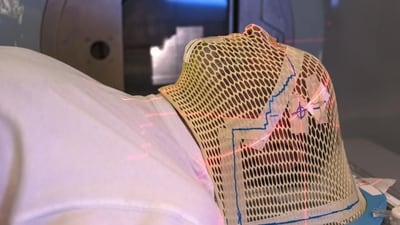 Radiation therapy tips: Ways to enhance treatment outcomes for cancer patients (Photo by Shutterstock) Radiation therapy tips: Ways to enhance treatment outcomes for cancer patients (Photo by Shutterstock)