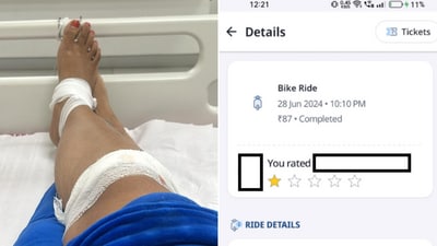 A 23-year-old Google techie shared this photo alleging she suffered these injuries after taking a Rapido bike in Bengaluru. (Screenshot) A 23-year-old Google techie shared this photo alleging she suffered these injuries after taking a Rapido bike in Bengaluru. (Screenshot)