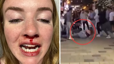 A same-sex couple were badly beaten by a group of men in an alleged 'homophobic attack' (X, formerly Twitter) A same-sex couple were badly beaten by a group of men in an alleged 'homophobic attack' (X, formerly Twitter)